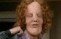 Rocky Dennis profile picture